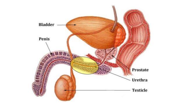 Urethral Stricture Diagram